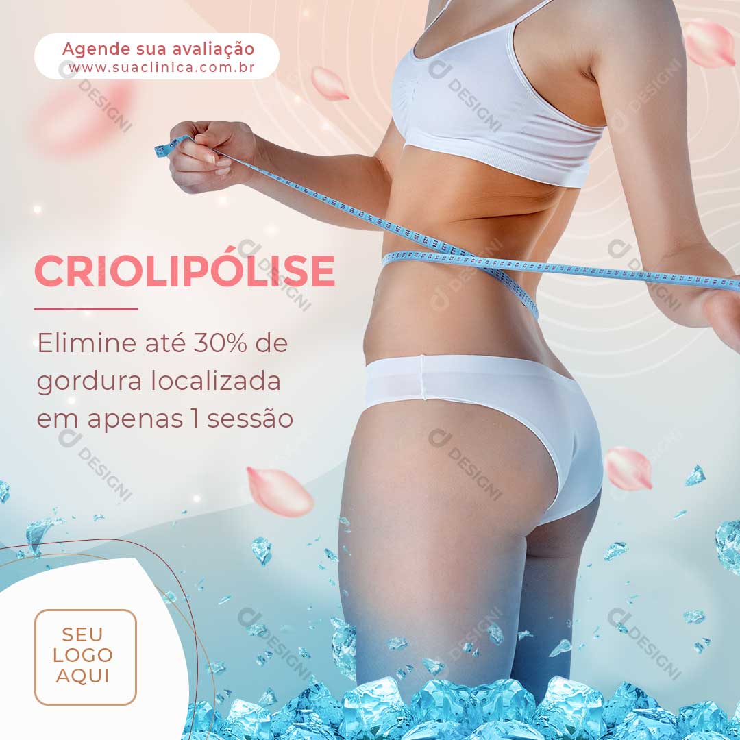 Criolipólise Social Media PSD Editável