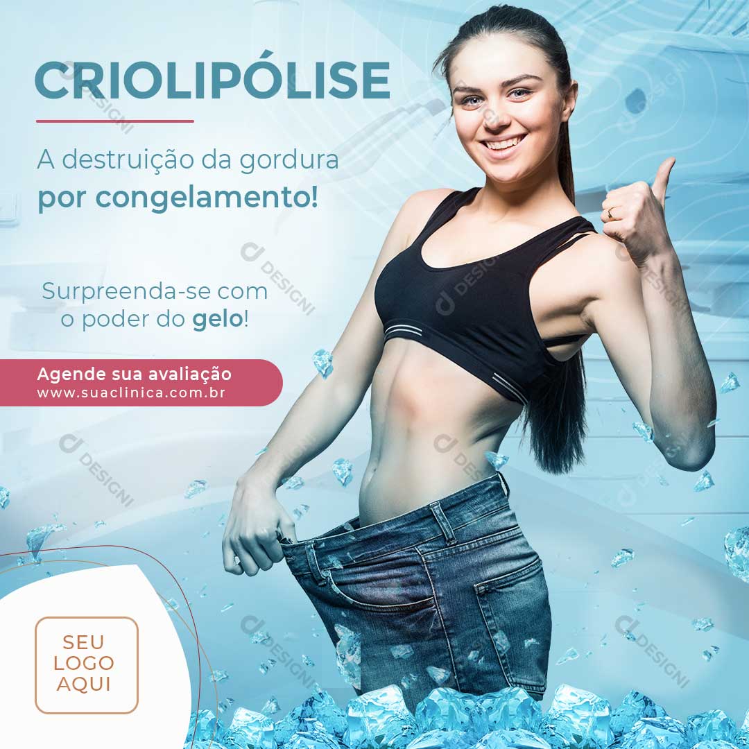 Criolipólise a Destruição de Gordura Por Congelamento Social Media PSD Editável
