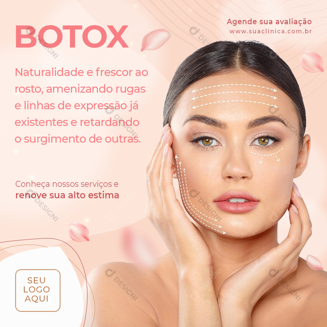 Botox Naturalidade e Frescor Social Media PSD Editável