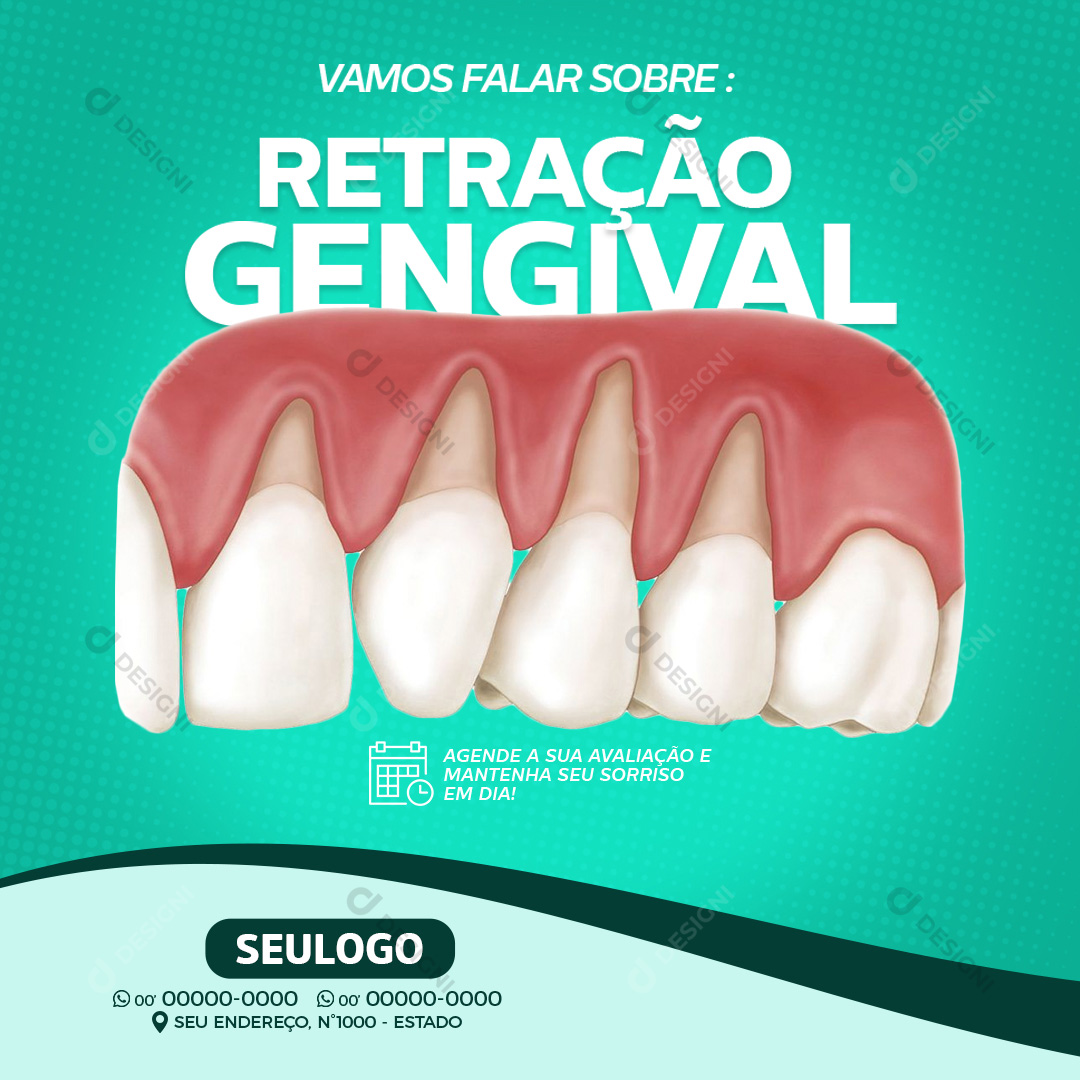 Retração Gengival Odontologia Social Media PSD Editável