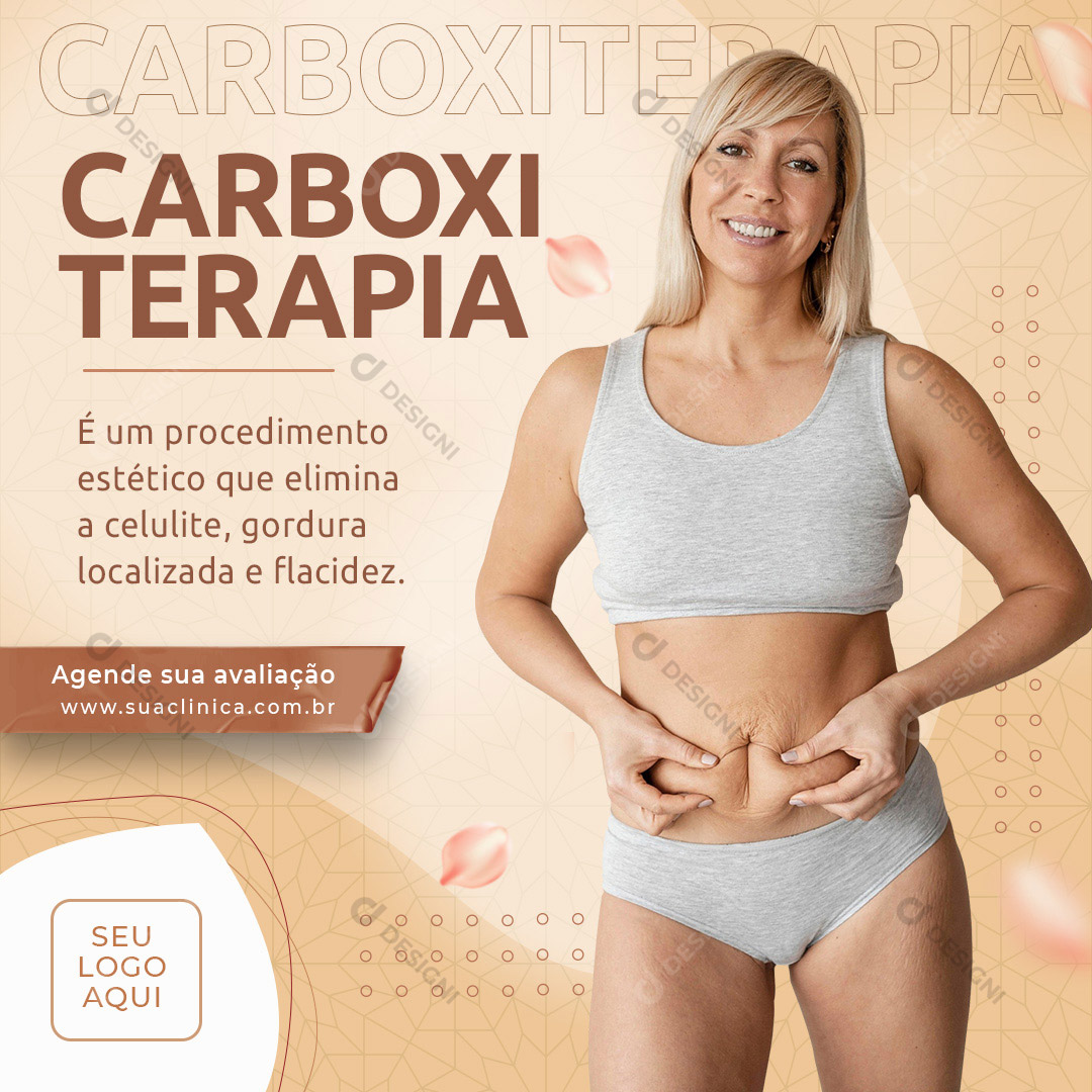 Carboxiterapia Procedimento Estético Social Media PSD Editável