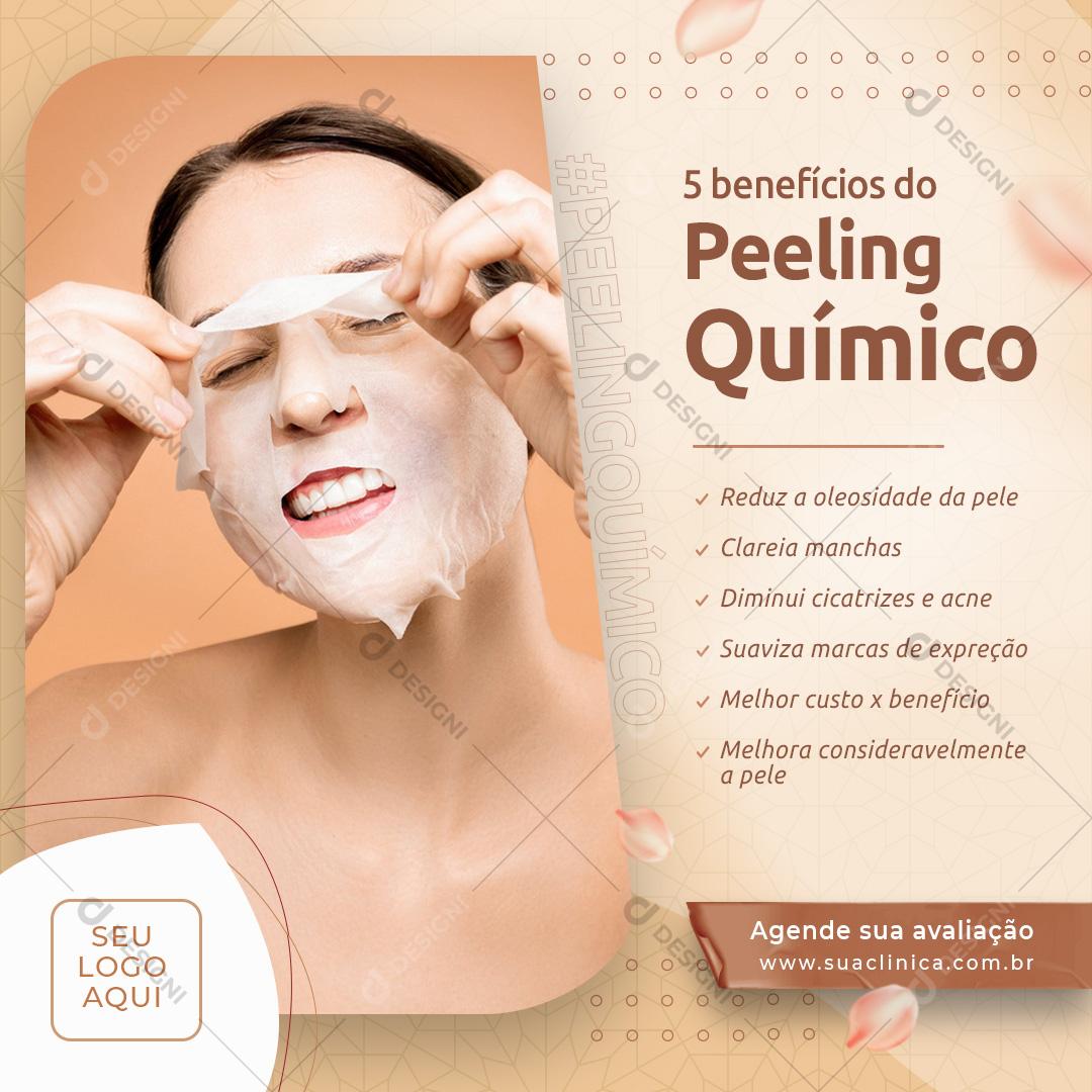 Post Feed 5 Benefícios do Peeling Químico Social Media PSD Editável