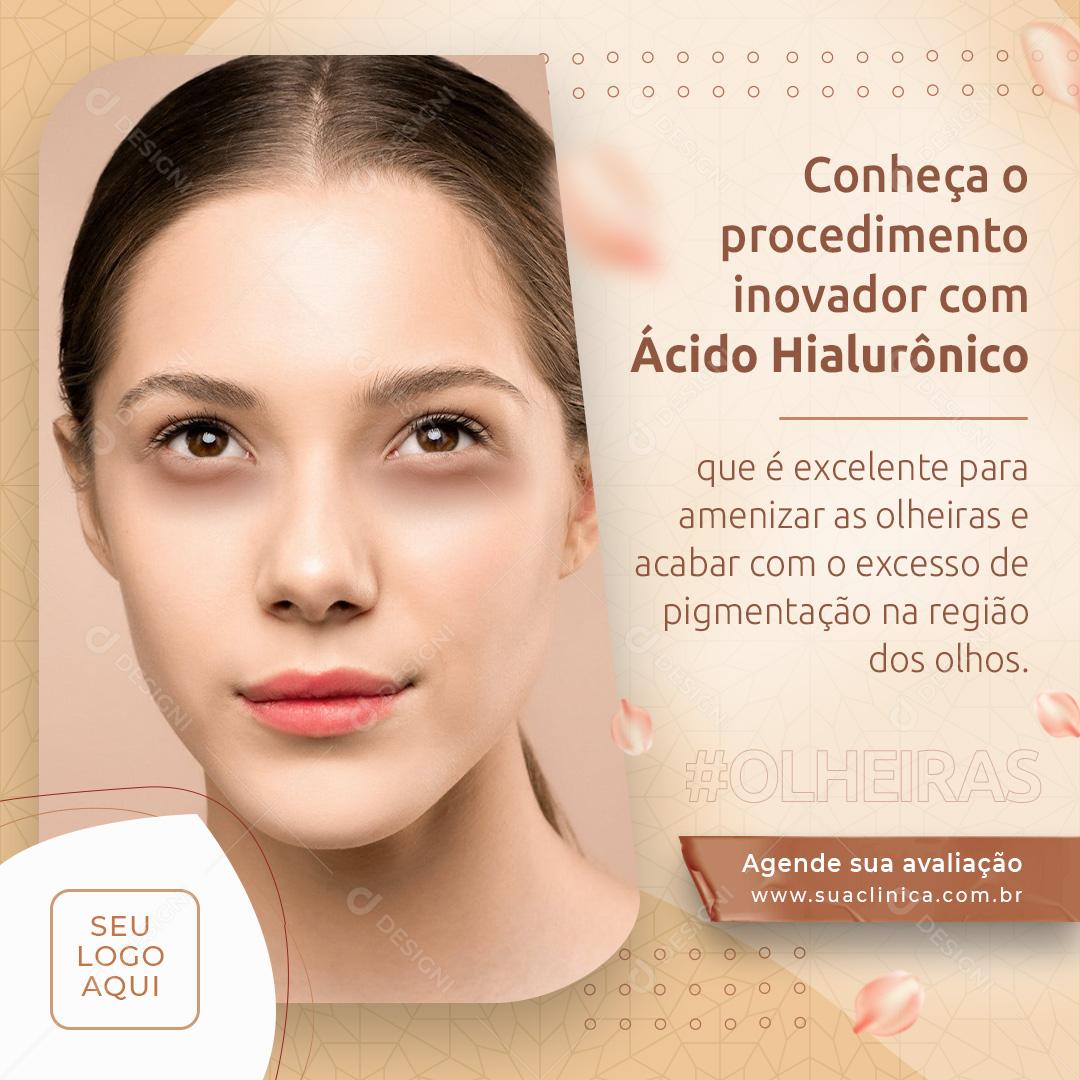 Conheça o Procedimento Inovador com Ácido Hialurônico Social Media PSD Editável