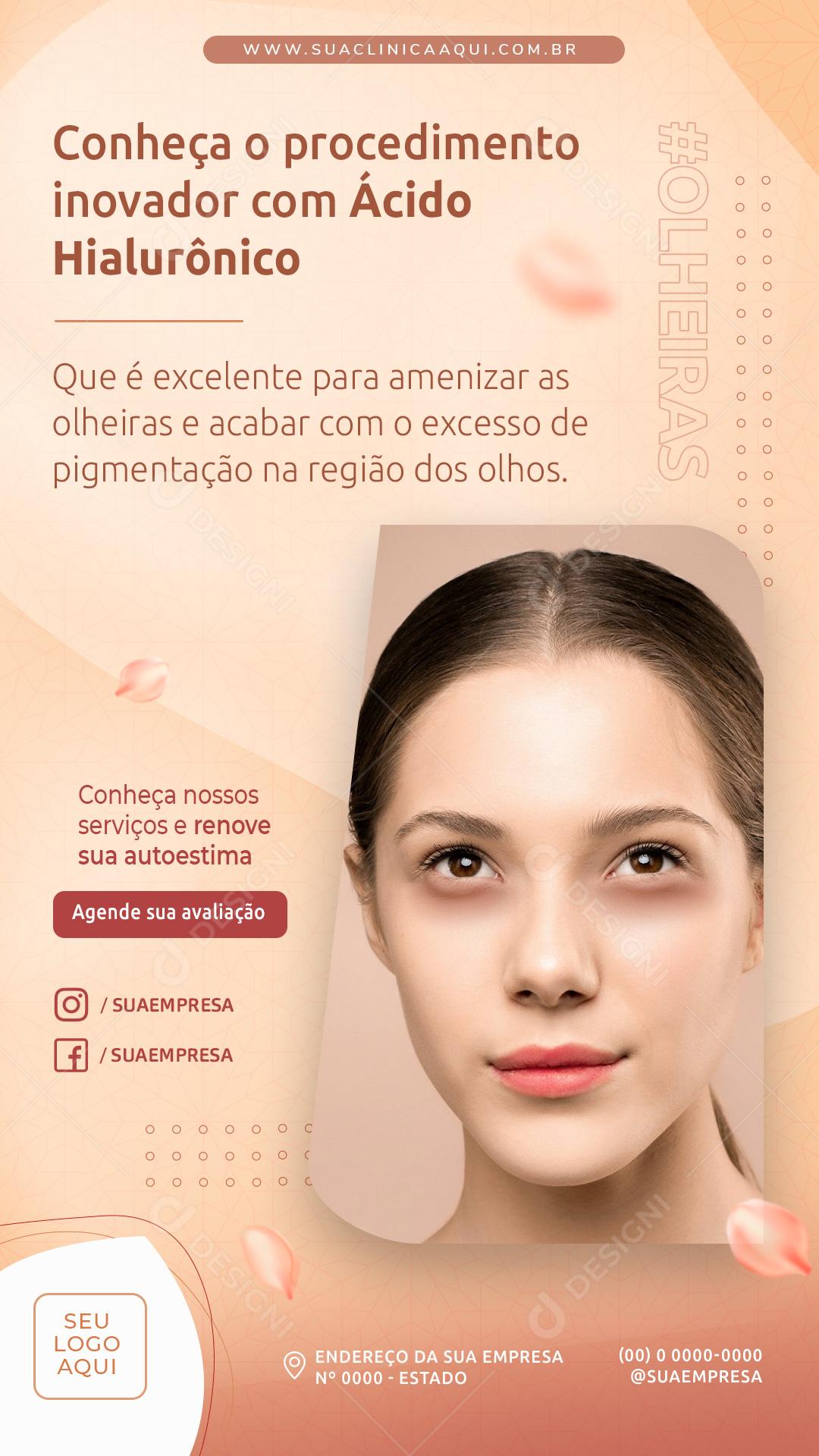 Post Story Clínica Conheça o Procedimento Inovador Social Media PSD Editável