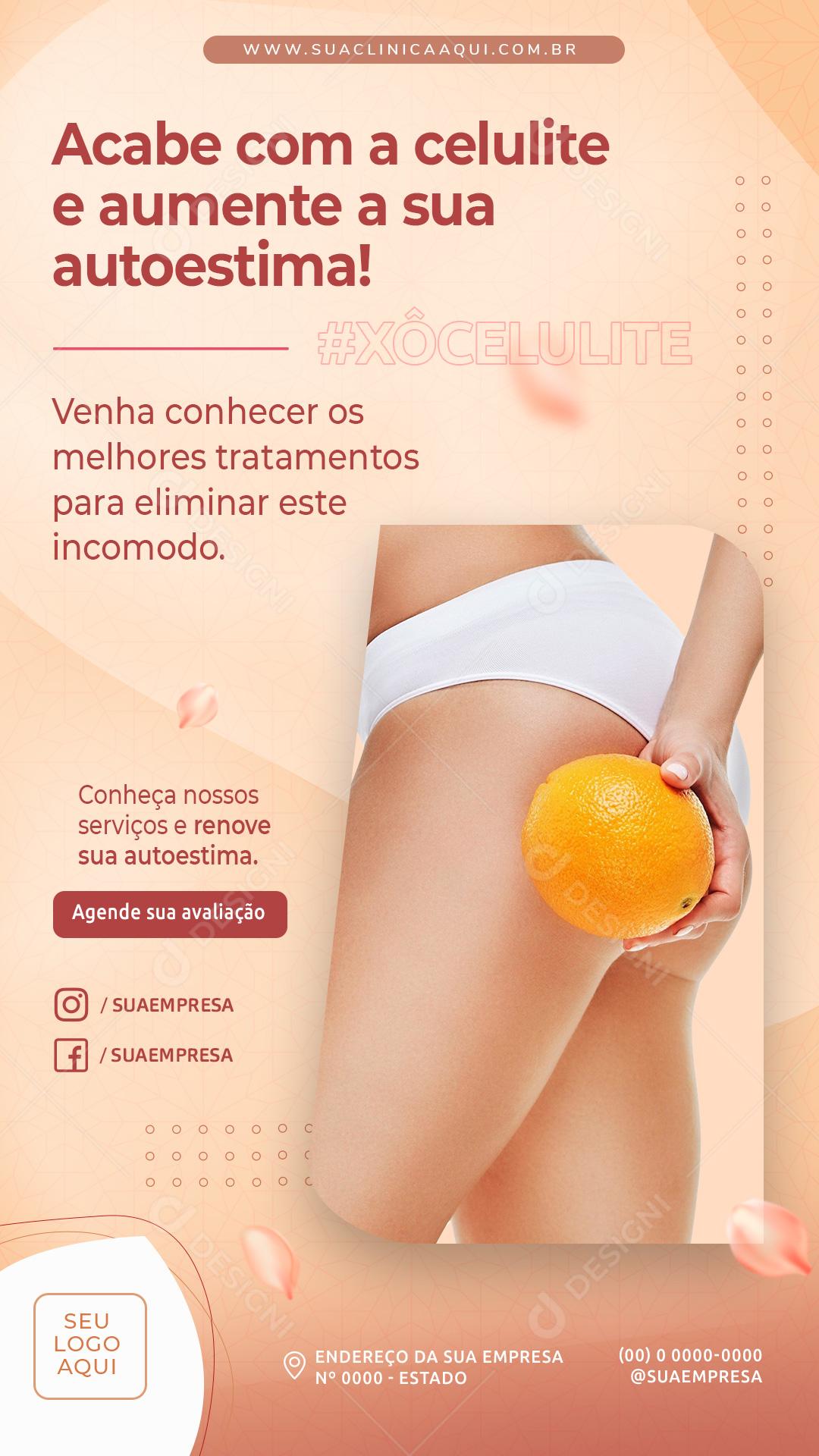 Story End Cellulite And Self-Esteem Social Media Editable PSD