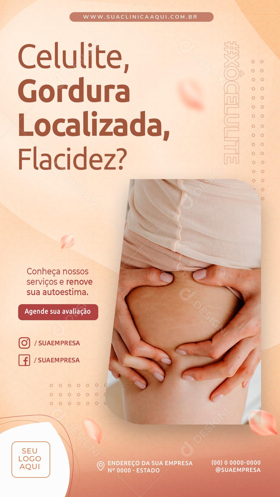 Story Celulite Gordura Localizada Flacidez Social Media PSD Editável
