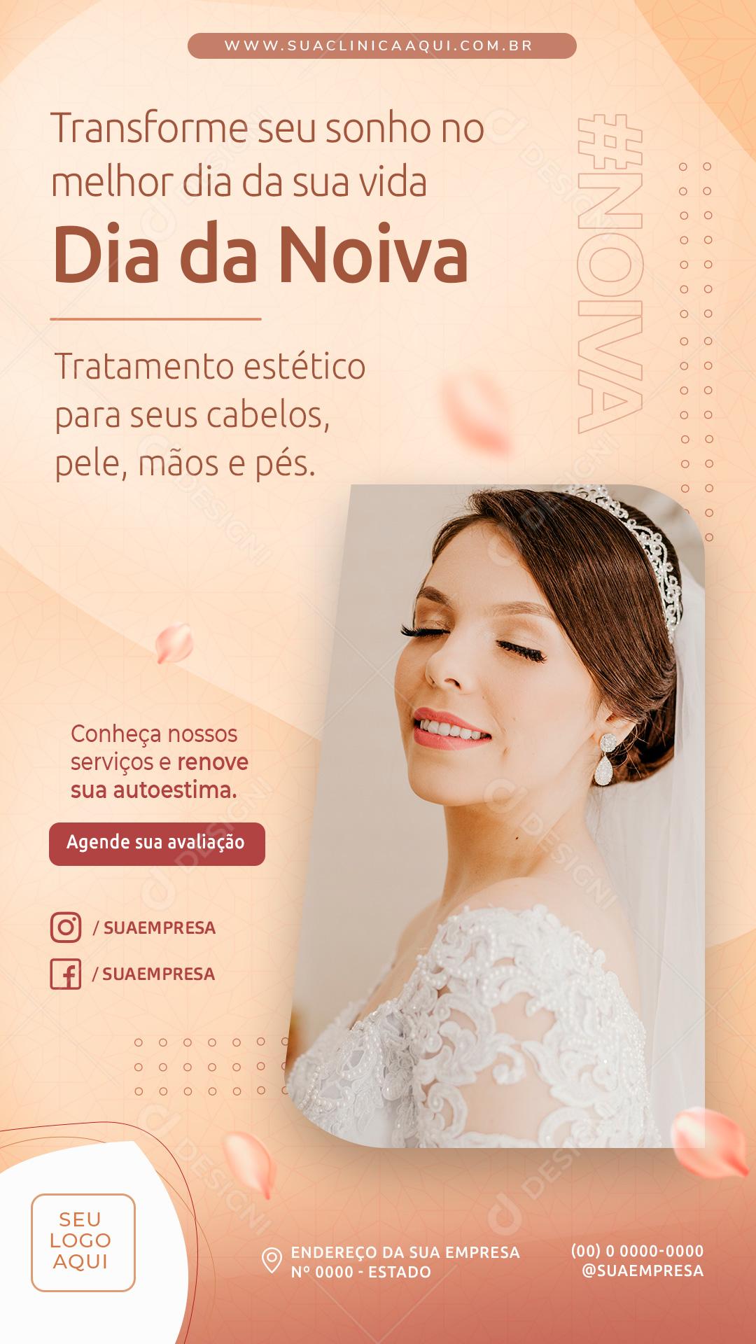 Story Dia Da Noiva Tratamento Estético Social Media PSD Editável