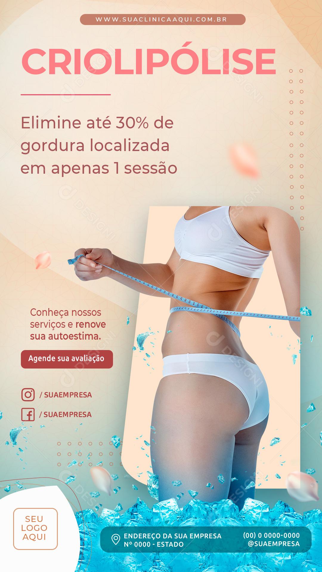 Criolipólise Elimine Até 30% De Gordura Localizada Social Media PSD Editável