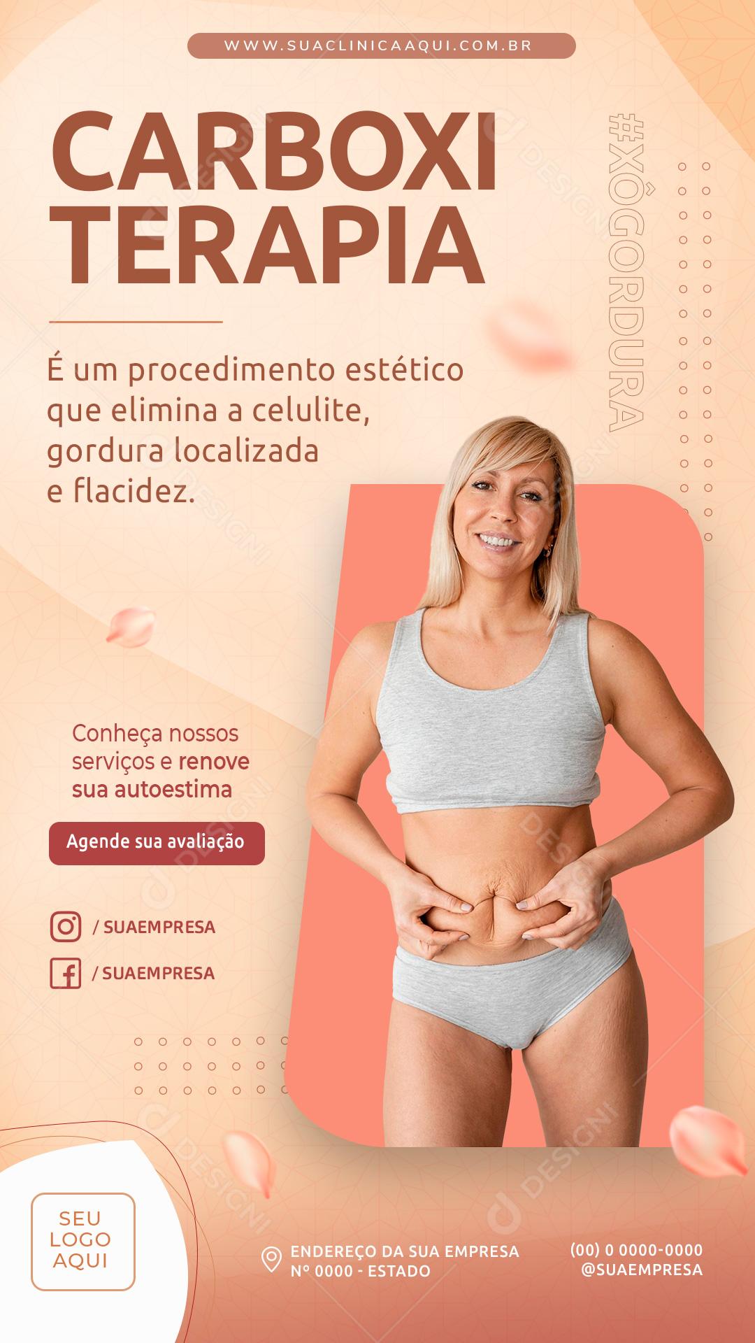 Post Story Clínica Carboxiterapia Social Media PSD Editável