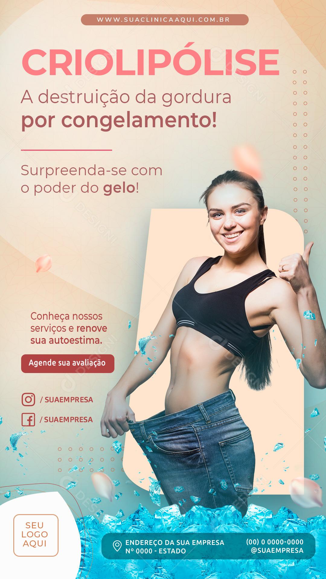 Post Story Clínica Criolipólise Poder do Gelo Social Media PSD Editável