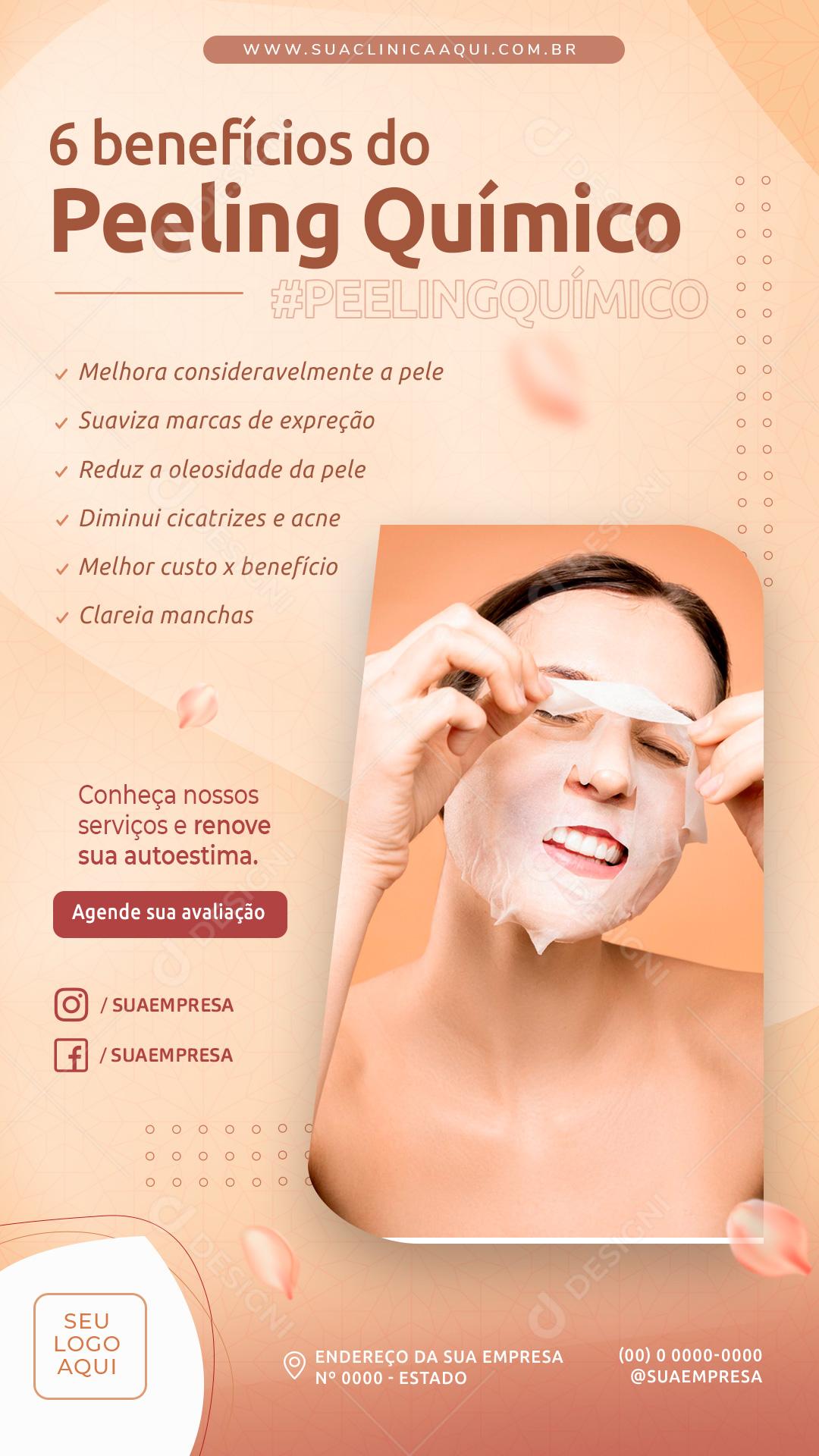 Post Story Clínica 6 benefícios do Peeling Químico Social Media PSD Editável