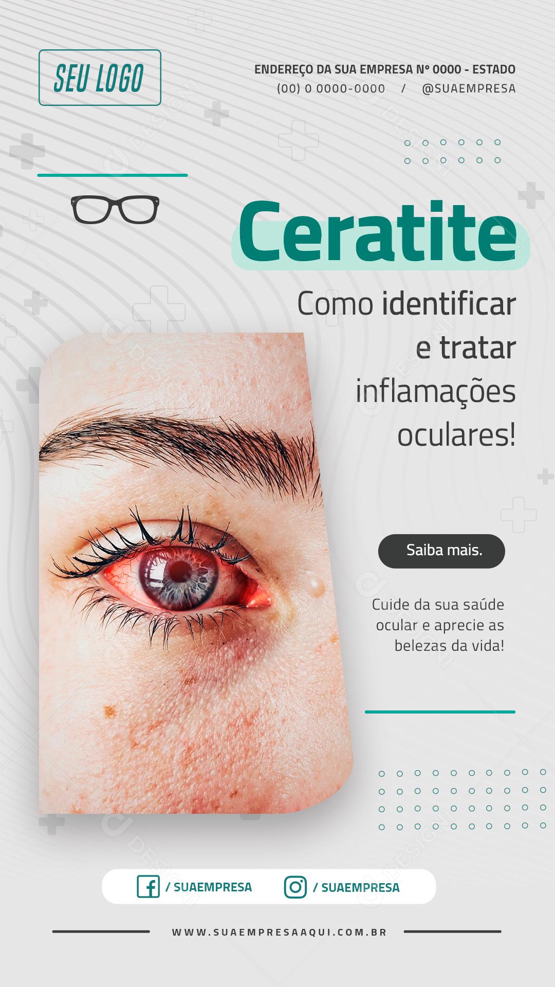 Story Ceratite Como Identificar e Tratar Inflamações Oculares Social Media PSD Editável