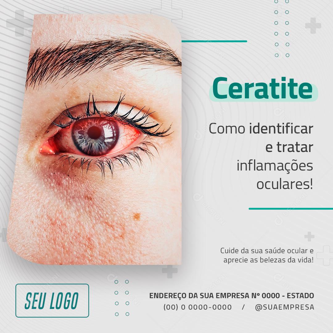 Ceratite Como Identificar e Tratar Inflamações Oculares Social Media PSD Editável