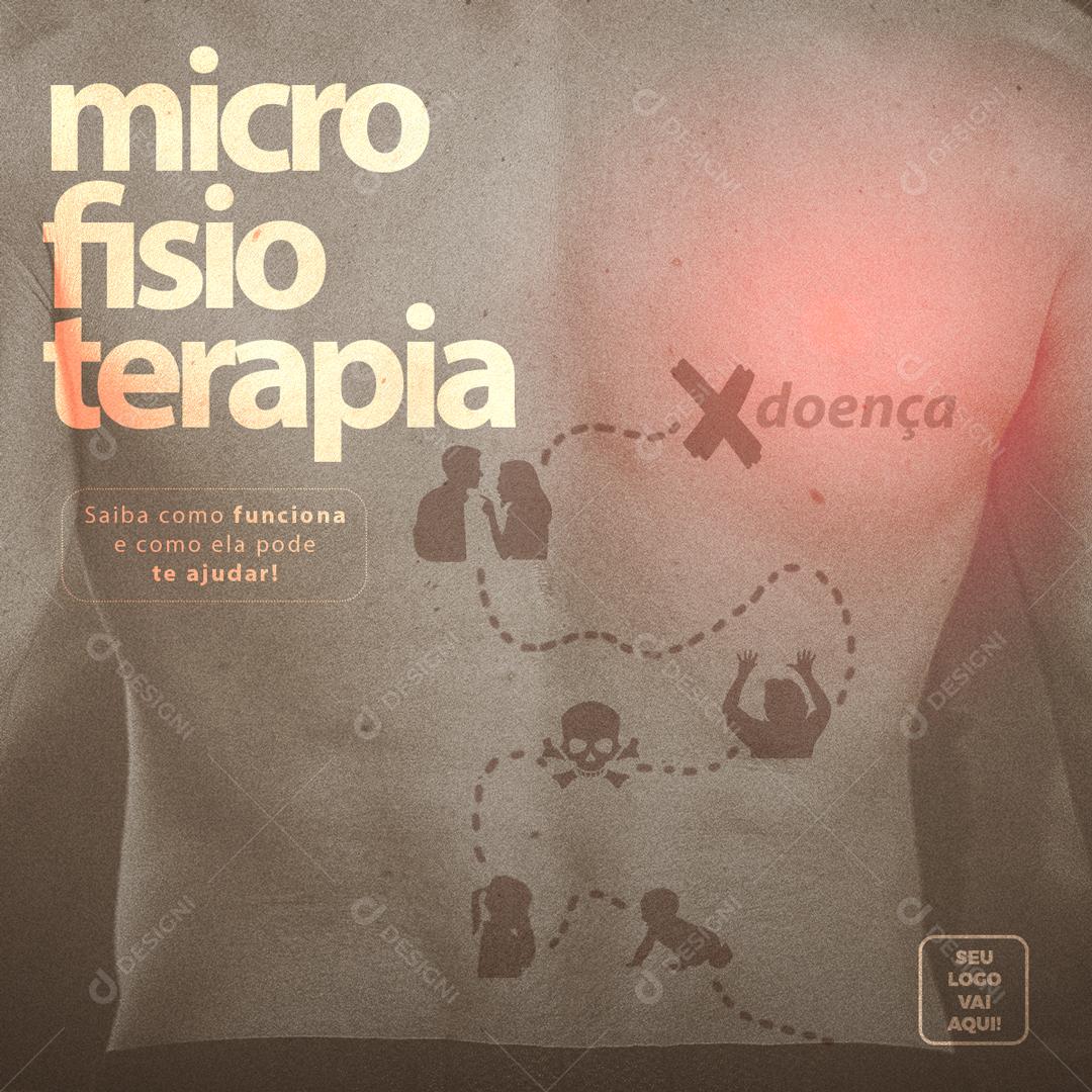 Micro fisioterapia Saiba Como Funciona E Como Ela Pode Te Ajudar Social Media PSD Editável