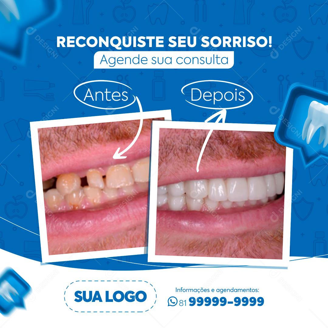 Post Feed Odontologia Dentista Social Media PSD Editável