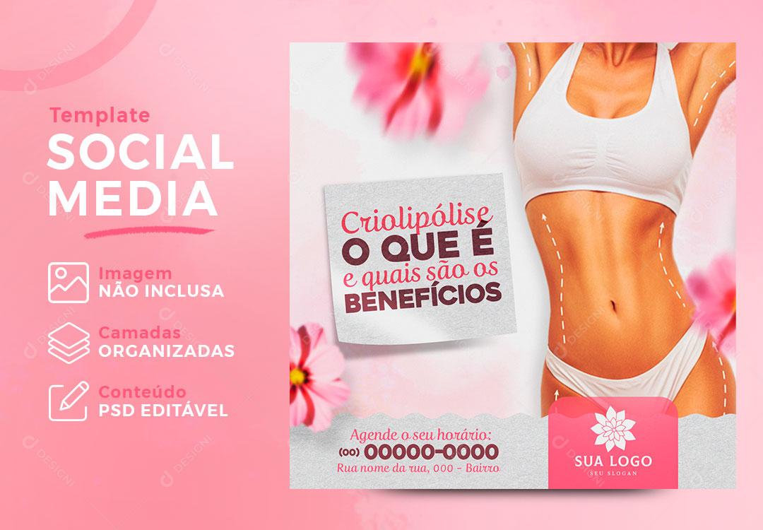 Social Media Estética Criolipólise Quais São Os Benefícios Social Media PSD Editavel