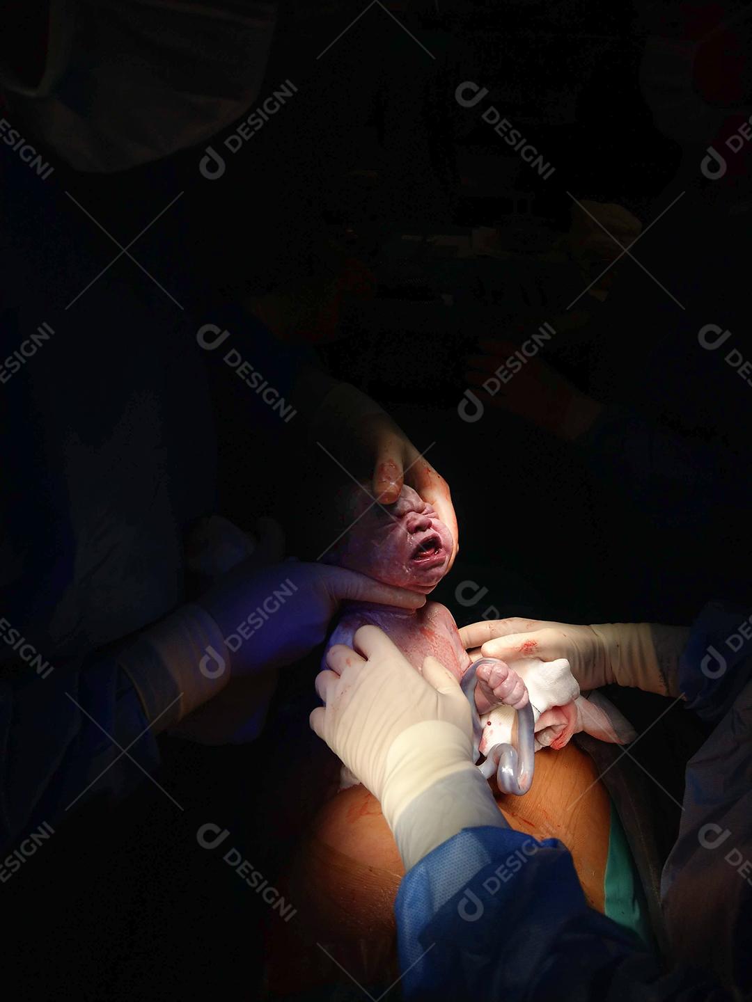 Sala Cirurgia Maternidade Dando Luz Criança Cesariana Hospital Imagem Foto JPG