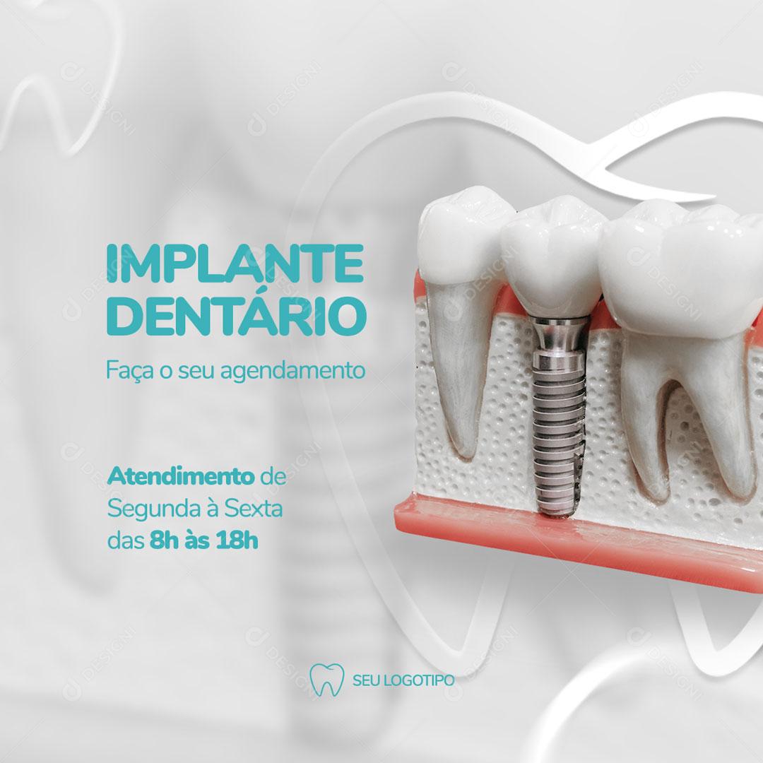 Implante Dentário Faça Seu Agendamento Social Media PSD Editável