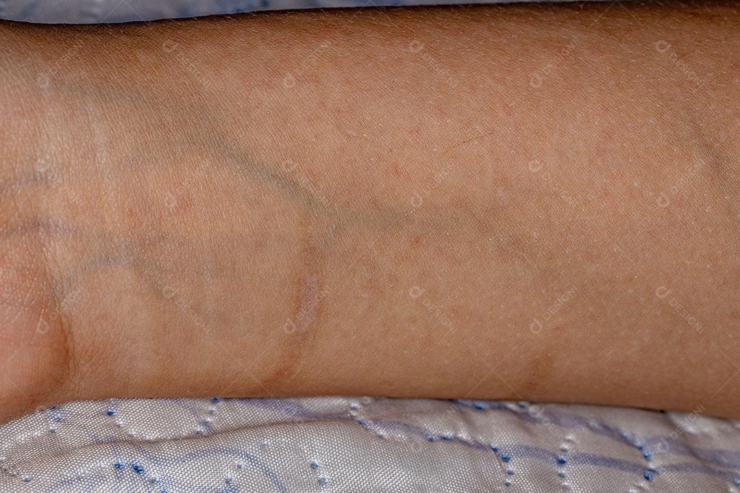 Pulso Humano Caucasiano com Alguns Pontos Sutis de Alergia Imagem JPG