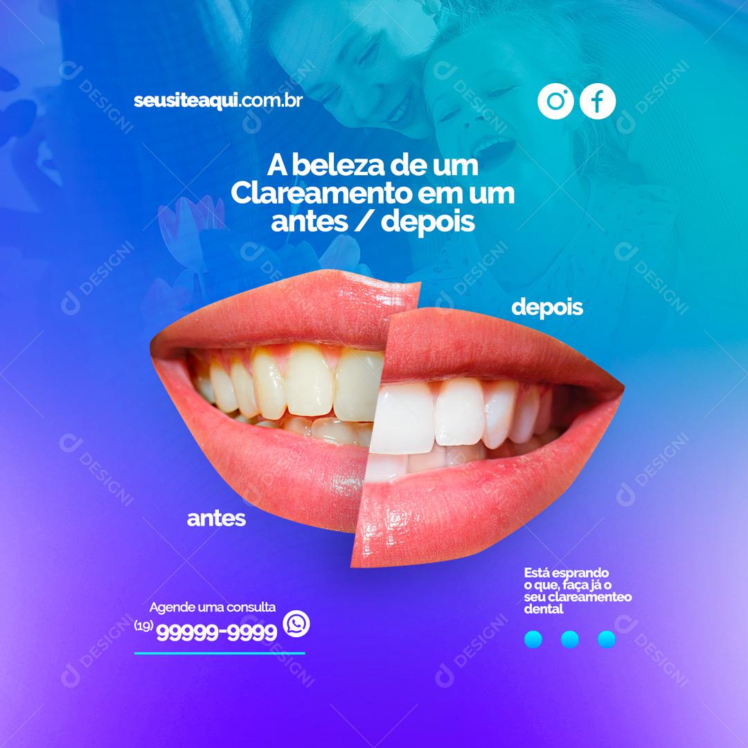 Social Media A beleza de um clareamento em um antes/depois Dentista PSD Editável