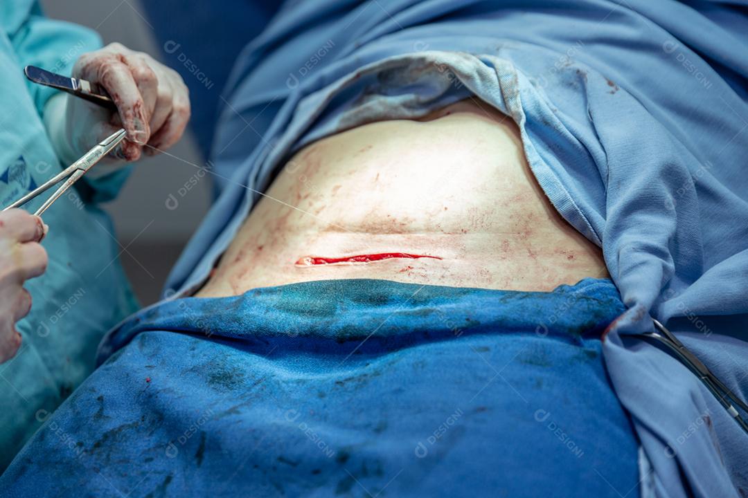 Cirugia em clinica hospital medicos