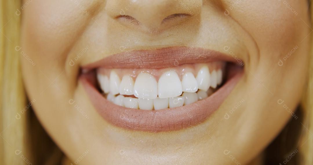 Feche de sorriso com dentes brancos e saudáveis. Belo sorriso largo de jovem fresca com grandes dentes brancos saudáveis