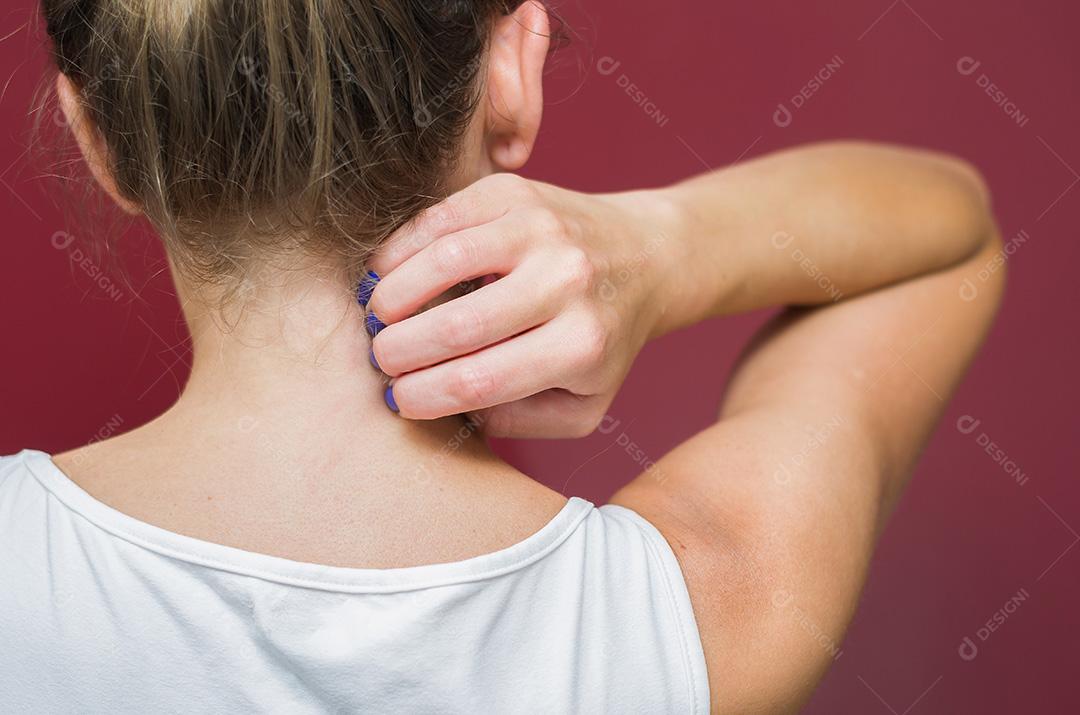 Grande conceito de alergia e doenças de pele, jovem scratchi