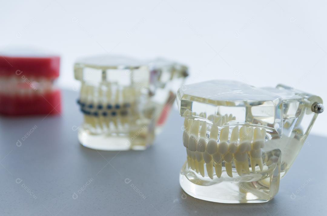 Modelo dental de aparelho dental invisível para mostrar ao cliente.