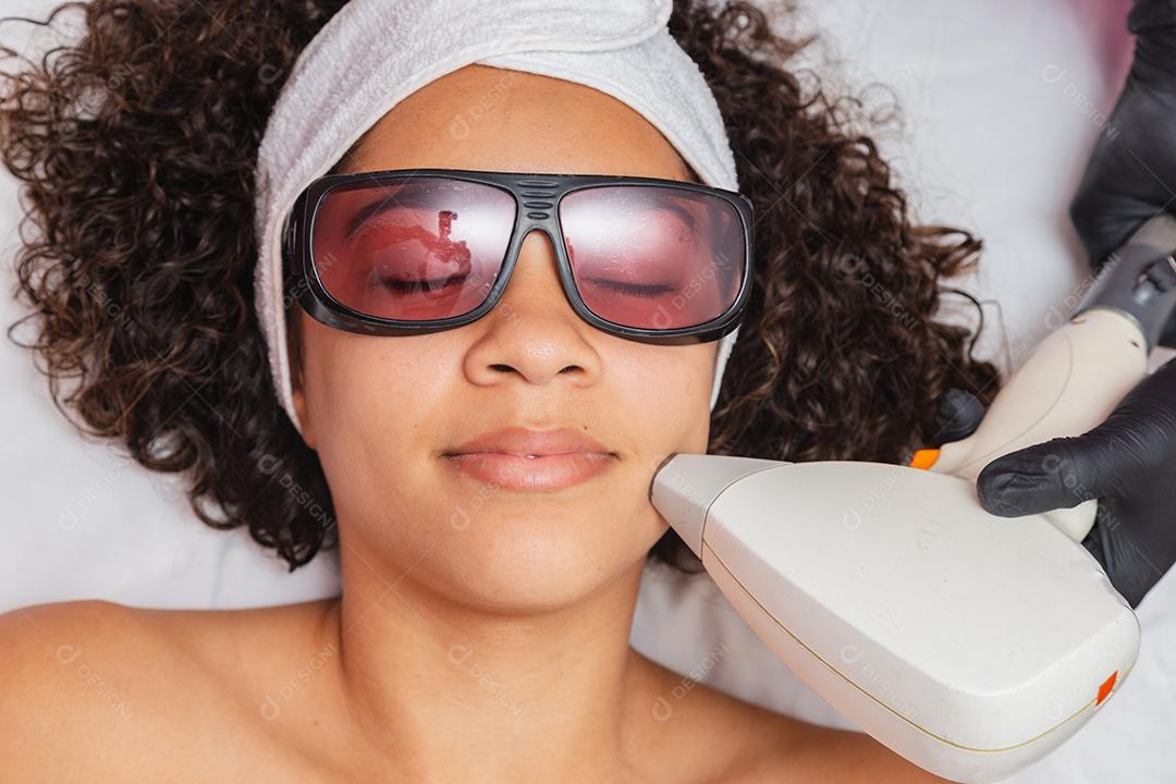 Mulher negra brasileira realizando depilação a laser no lábio superior
