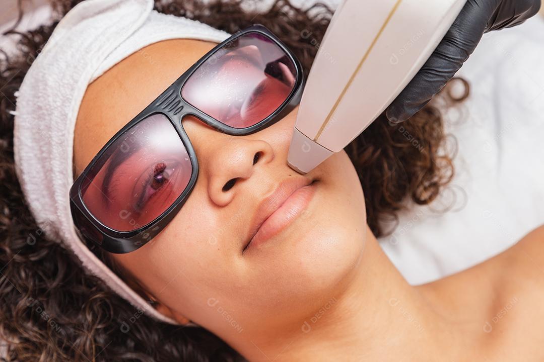 mulher negra brasileira realizando depilação a laser no lábio superior