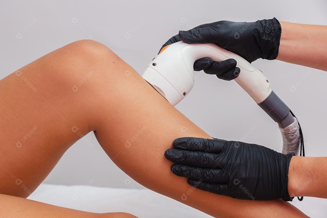 depilação a laser em mulher negra brasileira, depilação a laser na área da perna, panturrilha e canela