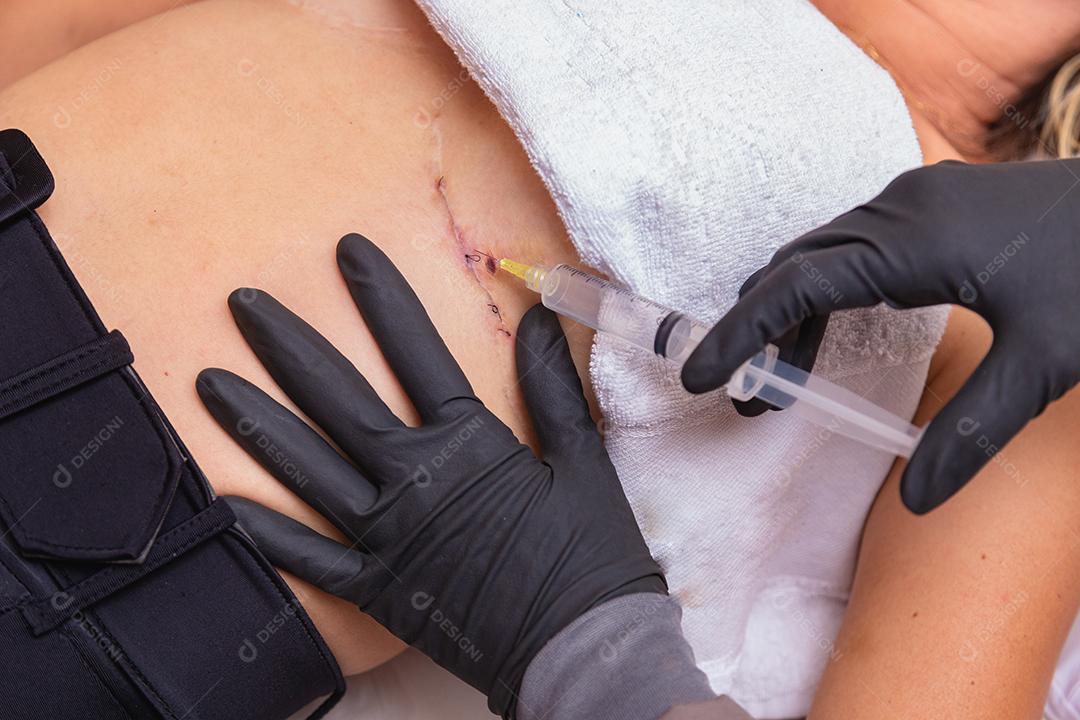 aesthetic healing procedure using ozone. Woman applying ozone after plastic surgery to speed up the healing process