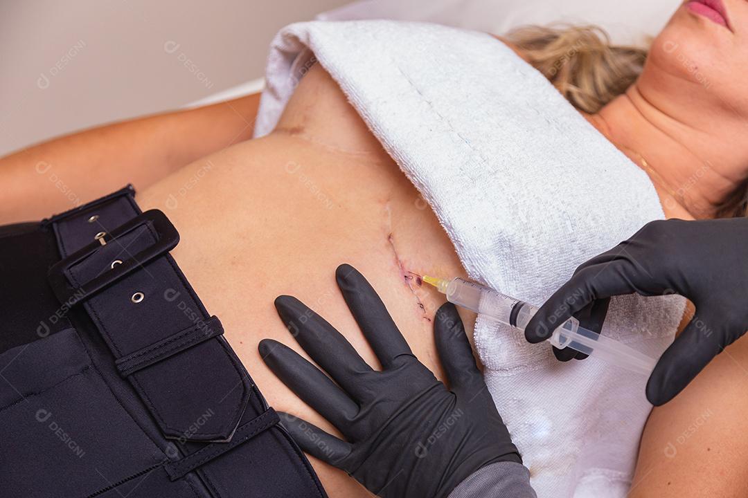 procedimento de cura estética usando ozônio. Mulher aplicando ozônio após cirurgia plástica para acelerar o processo de cicatrização