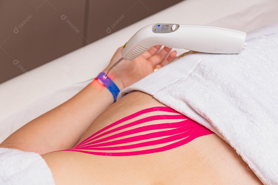 tratamento terapêutico com Kinesio Tapping