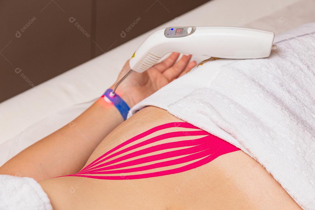 tratamento terapêutico com Kinesio Tapping