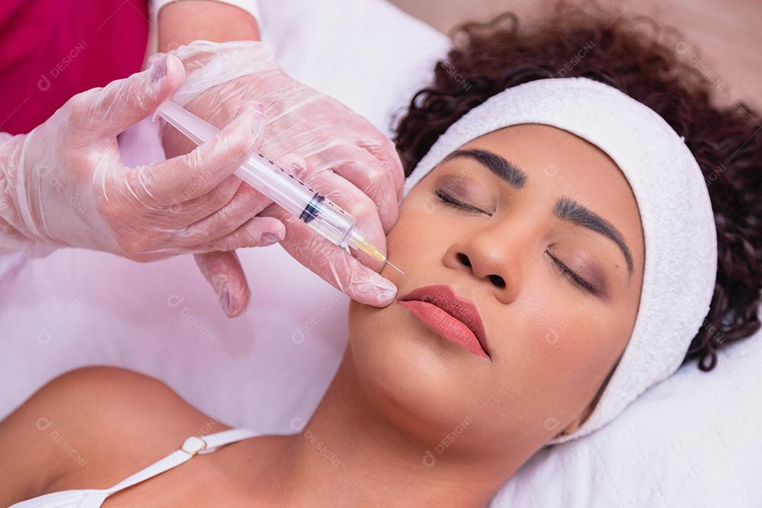 Application of hyaluronic acid and enzymes to the Japanese mustache on the young woman's face for aesthetic treatment.