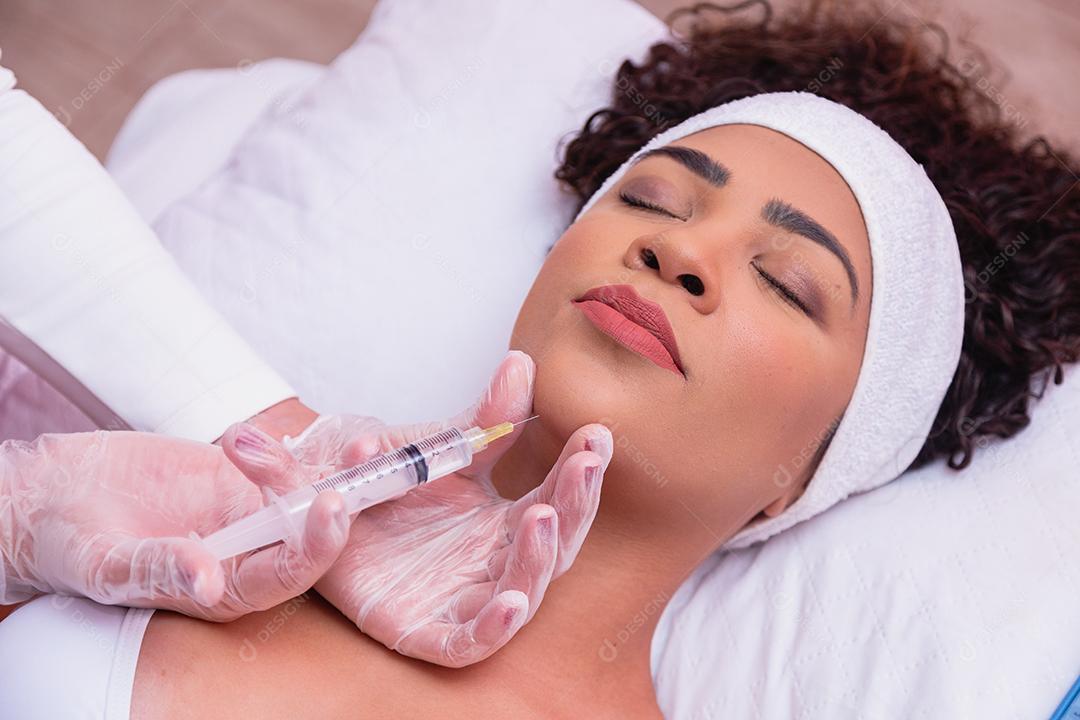 Application of hyaluronic acid and enzymes to the Japanese mustache on the young woman's face for aesthetic treatment.