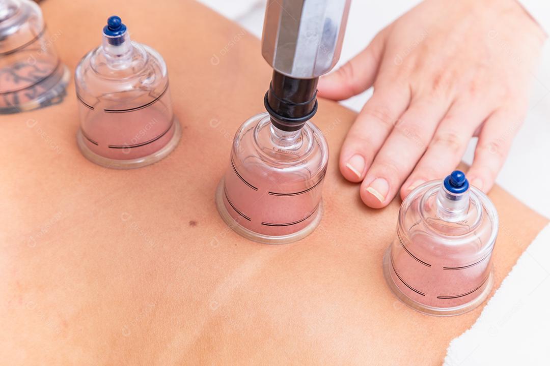 Mulher fazendo tratamento de ventosa em salão de estética