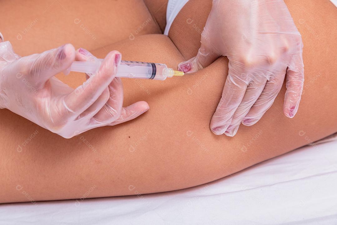 aplicação de enzimas para celulite. Mulher submetida a intradermoterapia para reduzir a celulite