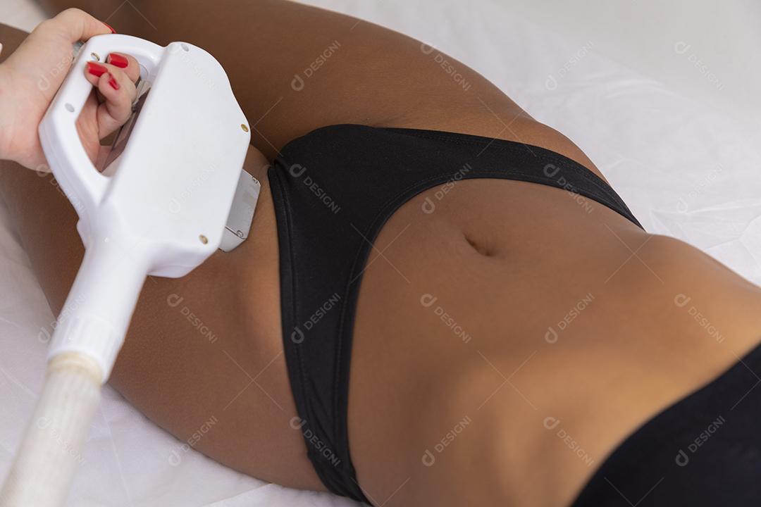 Mulher removendo os pêlos da virilha com fotodepilação. conceito de verão