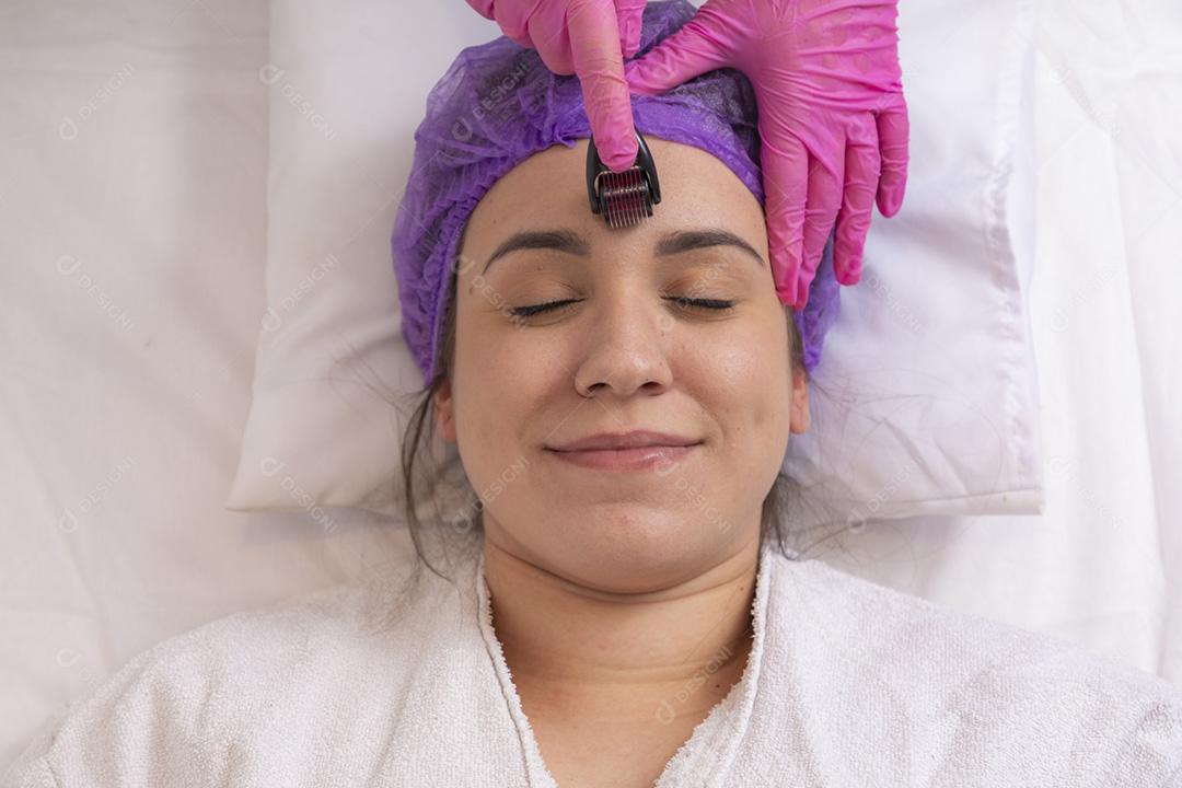 Rosto feminino de close-up com dermaroller para procedimentos de mesoterapia