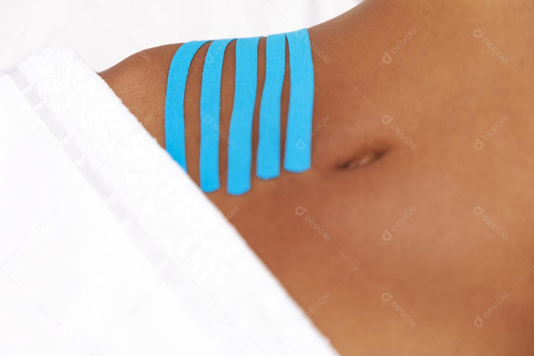 Fisioterapeuta usando Kinesio Tapping na barriga do paciente