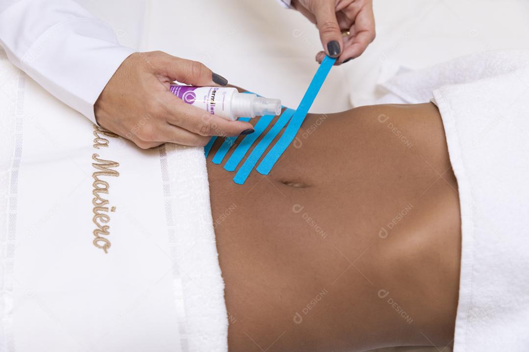 Fisioterapeuta usando Kinesio Tapping na barriga do paciente