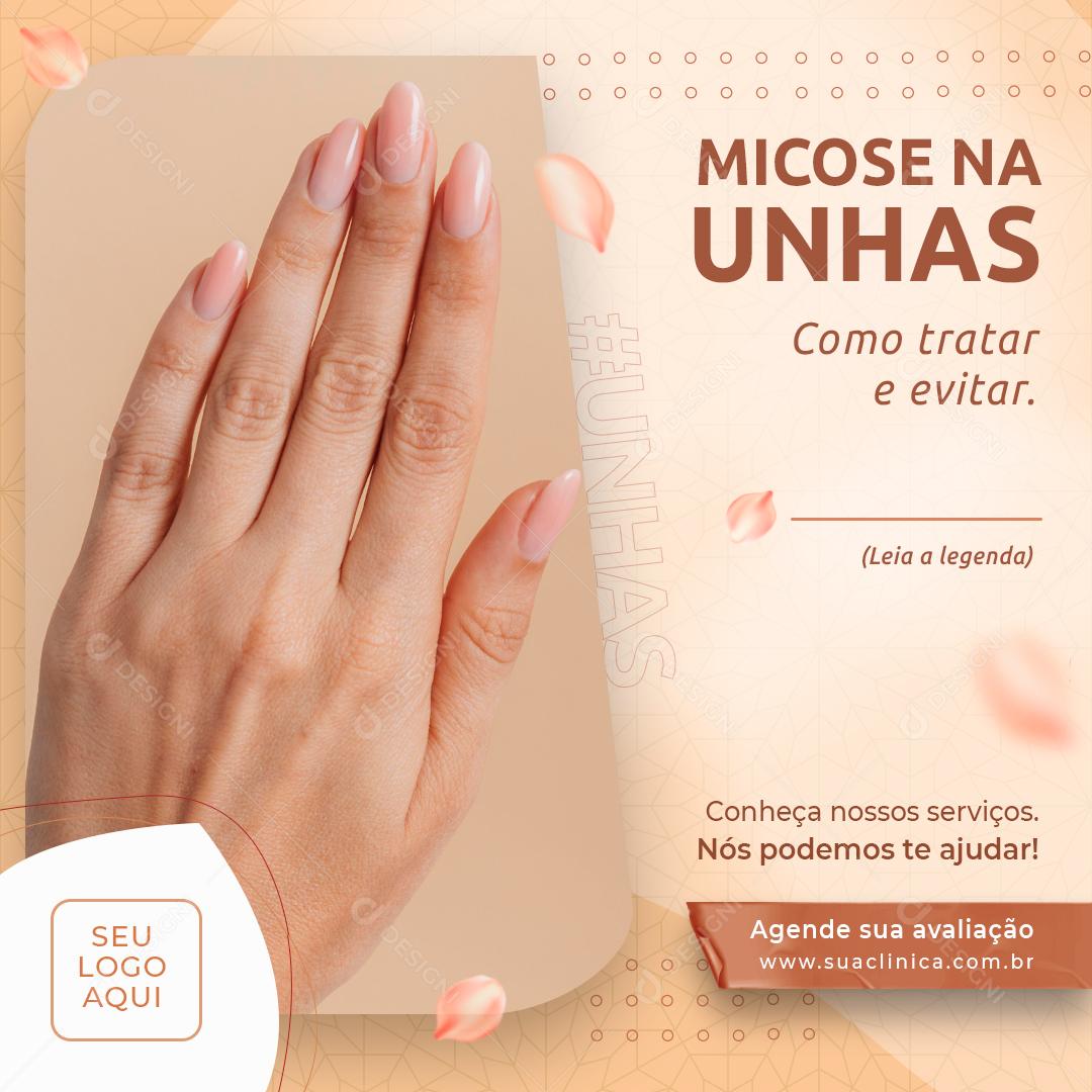 Social Media Micose na Unhas Manicure Clínica PSD Editável