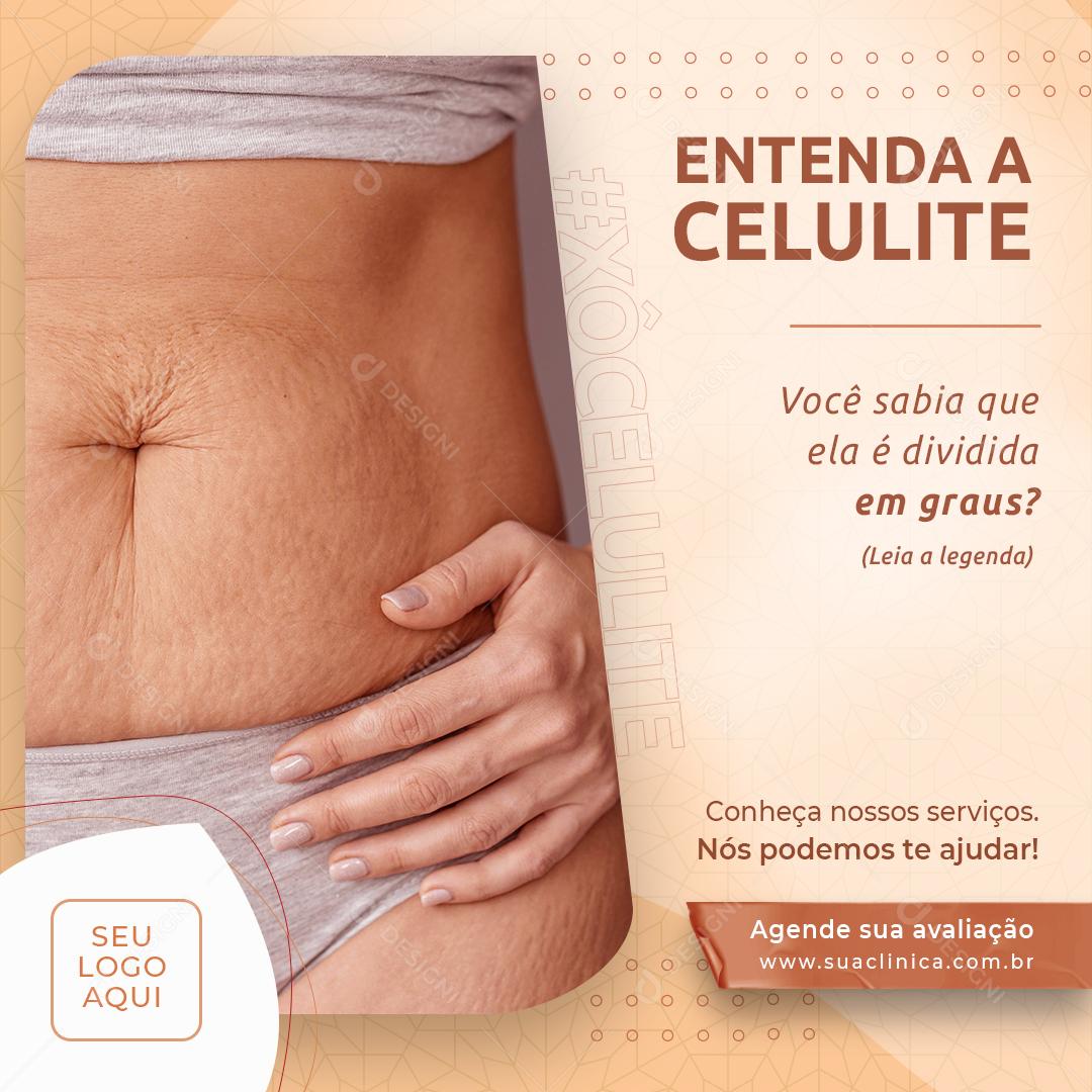 Social Media Entenda a Celulite Estética PSD Editável