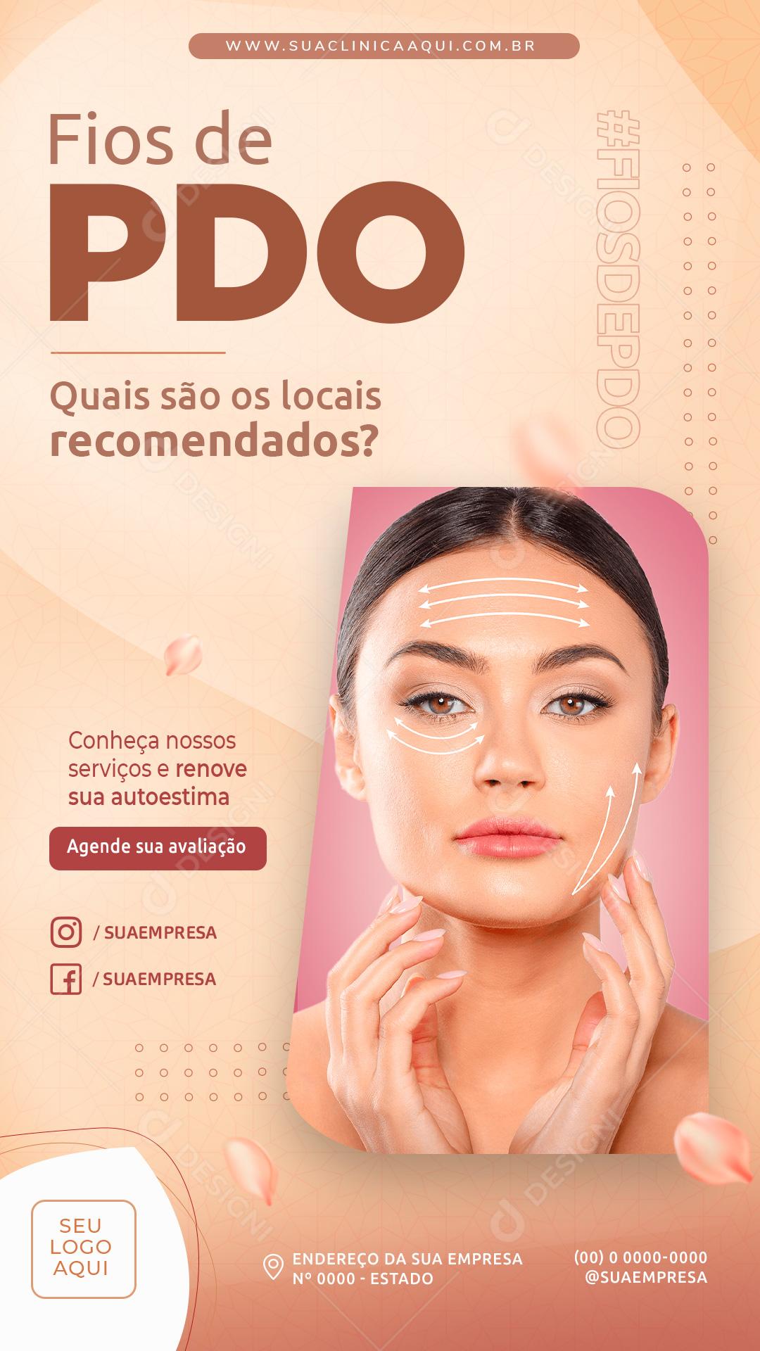 Social Media Story Clínica Fios de PDO Quais São os Locais PSD Editável