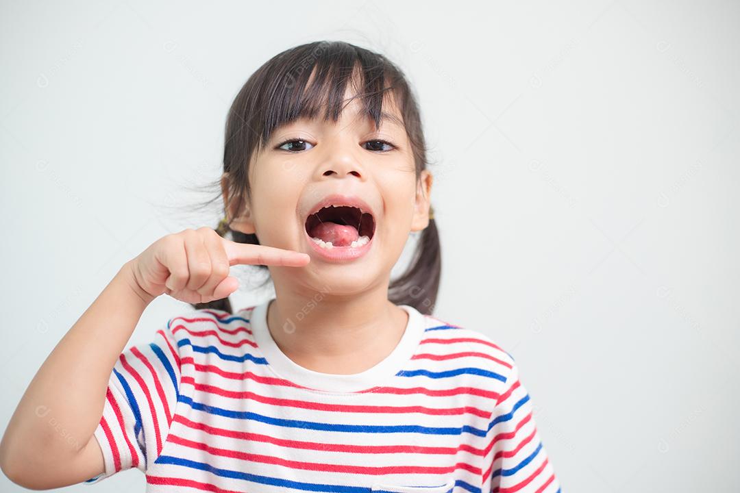 menina asiática mostrando seus dentes de leite quebrados.