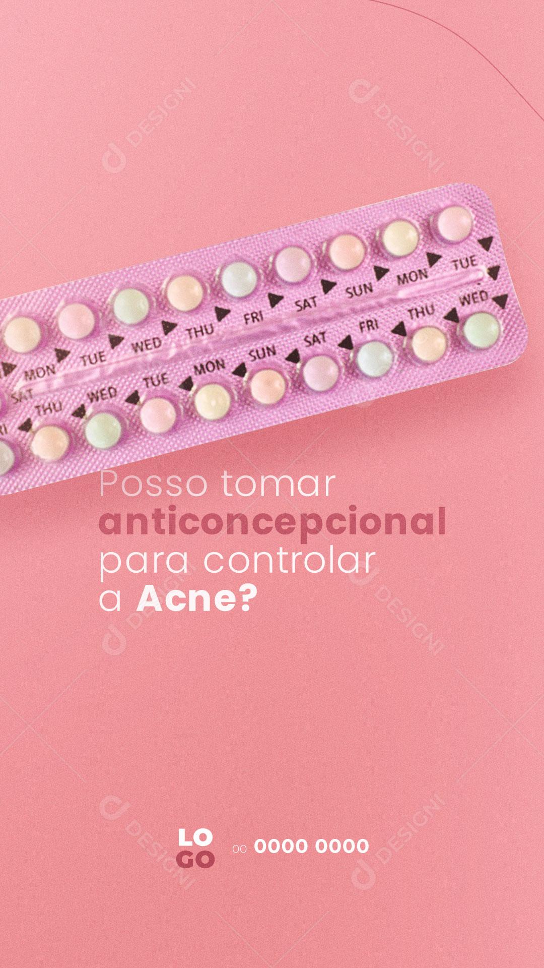 Social Media Story Clínica De Ginecologia E Obstetrícia Posso Tomar Anticoncepcional para Acne PSD Editável