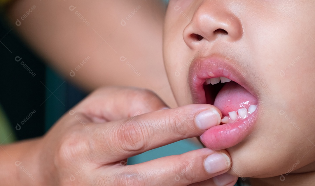 O bebê está abrindo a boca para a mãe usar a mão nos dentes para verificar se os dentes de leite estão prestes a afrouxar