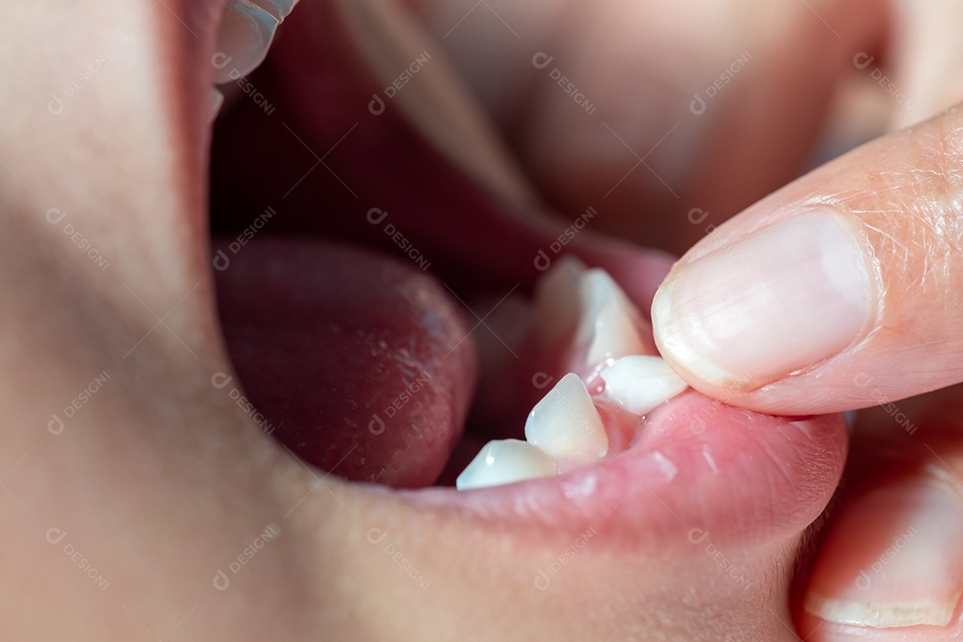 O bebê está abrindo a boca para a mãe usar a mão nos dentes para verificar se os dentes de leite estão prestes a afrouxar